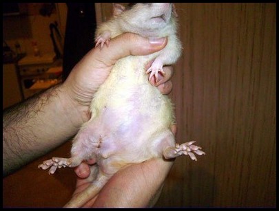 Cicatrice après opération d'une tumeur