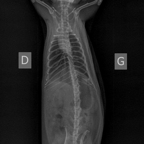 NAC-ABDOMEN FACE NORMAL-04_04_2022-14_56_20-157.JPEG